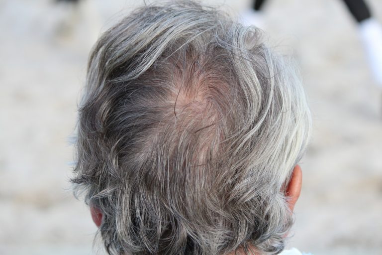 Back of head of man with gray hair