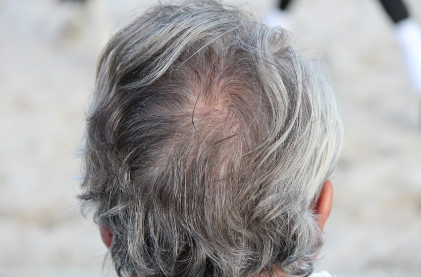  Why does hair turn gray?