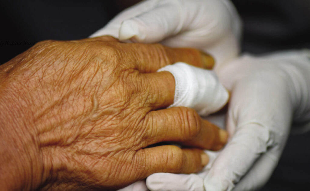 Hand of a senior woman with a bandage around her finger showing wound care